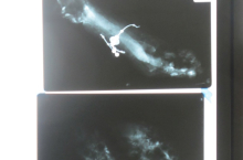 He Dreamed Overtime xrays (photo credit Beth Kapusta)